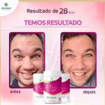 promoção do mês – BOTOX CAPS – 570mg – 30 Cápsulas (Linha Premium) - Imagem 3
